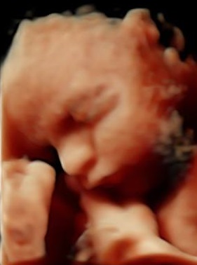 4D Baby Scan